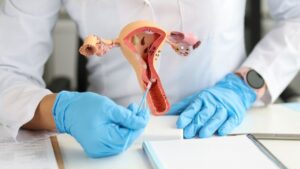 Papanicolau: Quando fazer o exame preventivo de colo de útero?